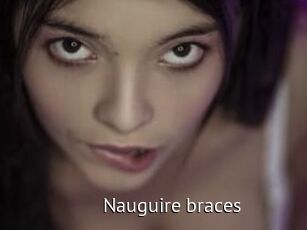 Nauguire_braces